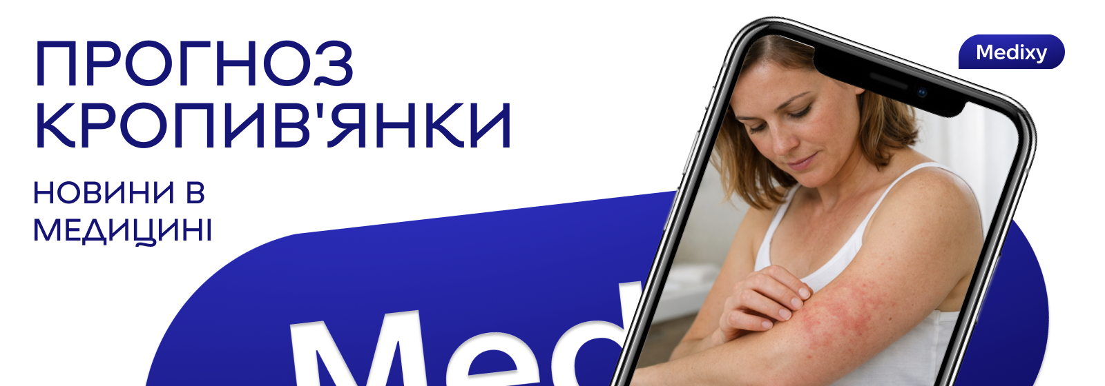 Хронічна кропивʼянка: чому хворобу досі неможливо передбачити?